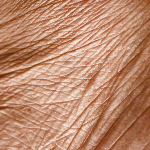 WRINKLES