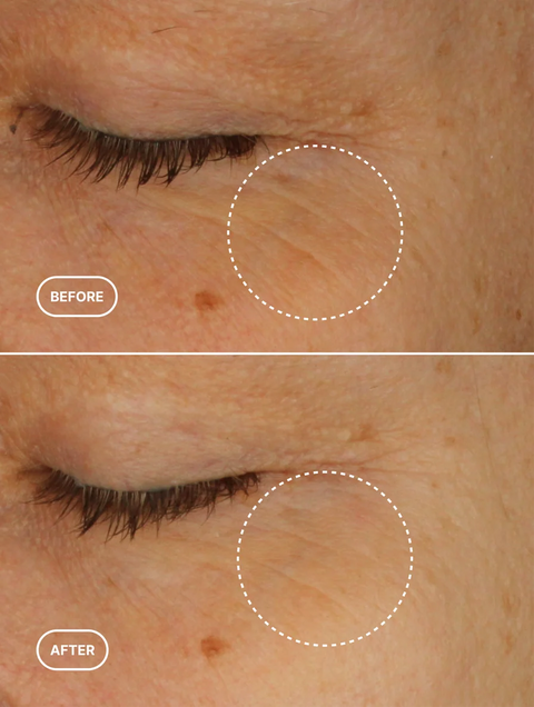 Periorbital Renewal Serum